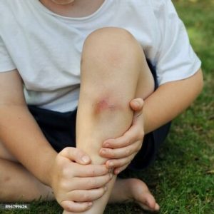Coups, Hématomes & Coupures